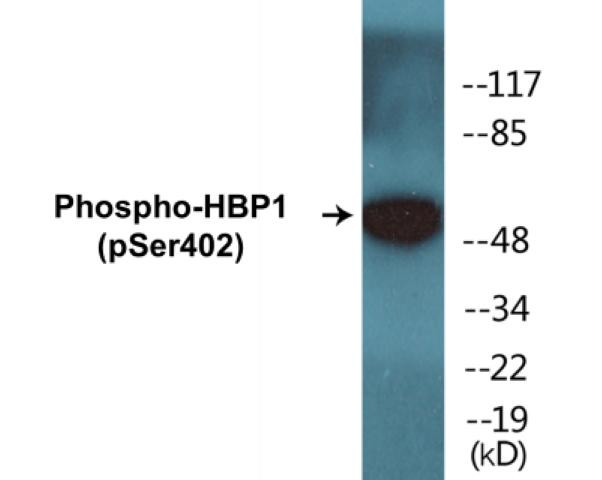 HBP1 (Phospho-Ser402)Colorimetric Cell-Based ELISA Kit (CBCAB01448)