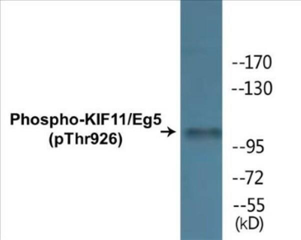 KIF11/Eg5 (Phospho-Thr926)Colorimetric Cell-Based ELISA Kit (CBCAB01460)