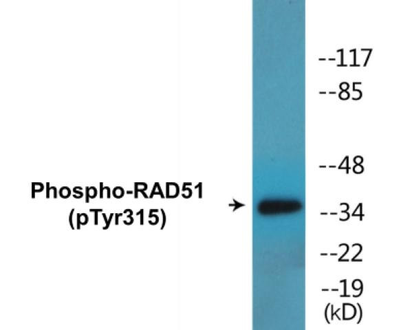 RAD51 (Phospho-Tyr315)Colorimetric Cell-Based ELISA Kit (CBCAB01463)