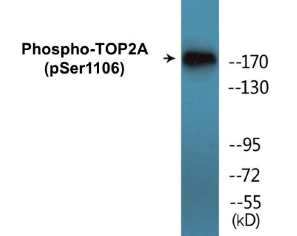 TOP2A (Phospho-Ser1106)Colorimetric Cell-Based ELISA Kit (CBCAB01467)