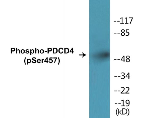 PDCD4 (Phospho-Ser457)Colorimetric Cell-Based ELISA Kit (CBCAB01475)