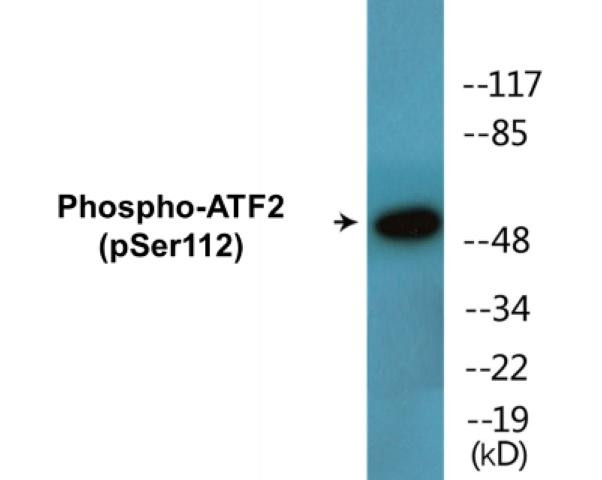 ATF2 (Phospho-Ser112)Colorimetric Cell-Based ELISA Kit (CBCAB01492)