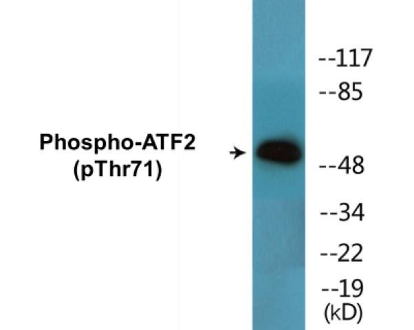 ATF2 (Phospho-Thr71)Colorimetric Cell-Based ELISA Kit (CBCAB01494)