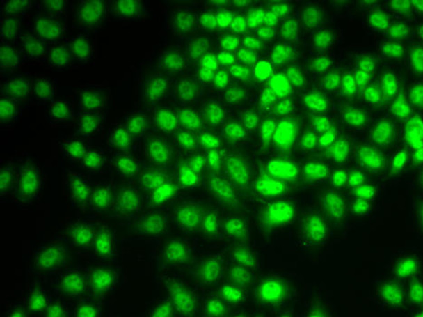 Anti-Cyclin G1 Antibody (CAB14713)