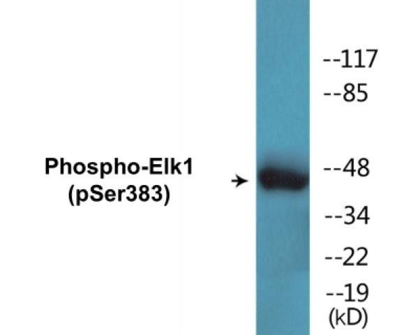 Elk1 (Phospho-Ser383)Colorimetric Cell-Based ELISA Kit (CBCAB01521)