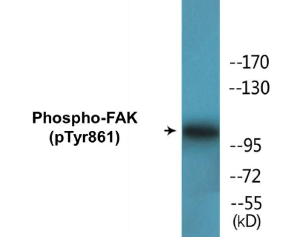 FAK (Phospho-Tyr861)Colorimetric Cell-Based ELISA Kit (CBCAB01528)