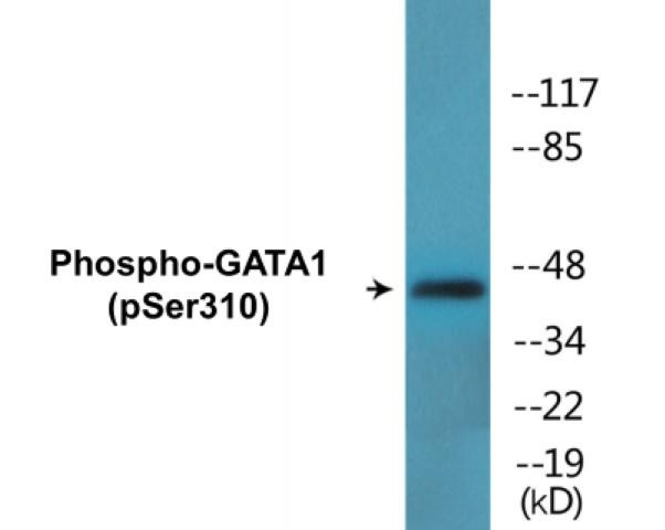 GATA1 (Phospho-Ser310)Colorimetric Cell-Based ELISA Kit (CBCAB01535)