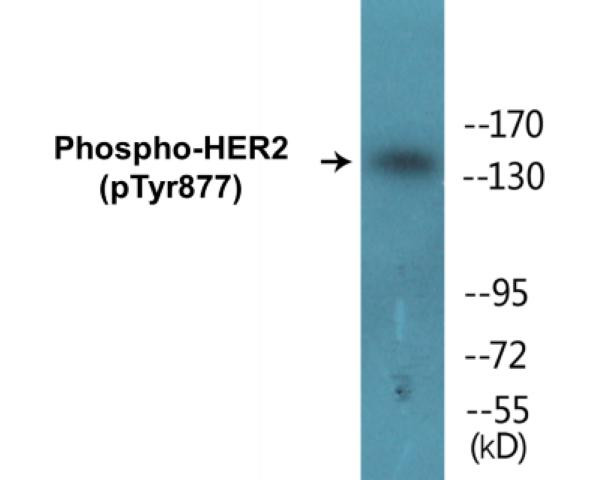 HER2 (Phospho-Tyr877)Colorimetric Cell-Based ELISA Kit (CBCAB01542)