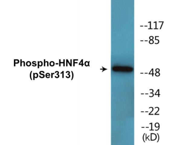 HNF4alpha (Phospho-Ser313)Colorimetric Cell-Based ELISA Kit (CBCAB01544)