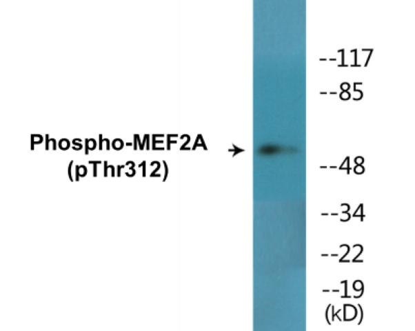 MEF2A (Phospho-Thr312)Colorimetric Cell-Based ELISA Kit (CBCAB01563)