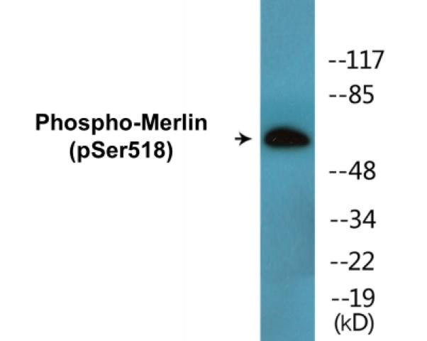 Merlin (Phospho-Ser518)Colorimetric Cell-Based ELISA Kit (CBCAB01569)
