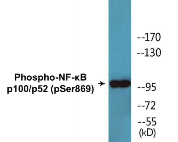 NF-kappaB p100/p52 (Phospho-Ser869)Colorimetric Cell-Based ELISA Kit (CBCAB01575)