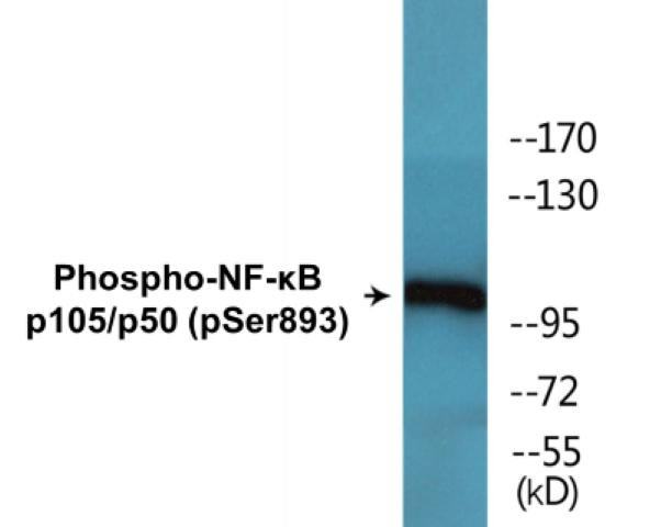 NF-kappaB p105/p50 (Phospho-Ser893)Colorimetric Cell-Based ELISA Kit (CBCAB01576)