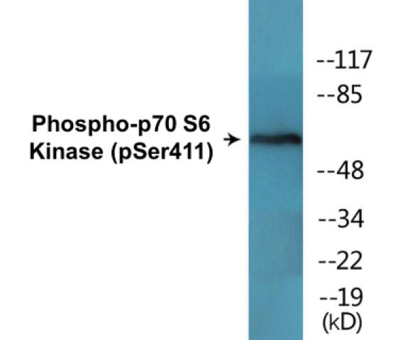 p70 S6 Kinase (Phospho-Ser411)Colorimetric Cell-Based ELISA Kit (CBCAB01592)