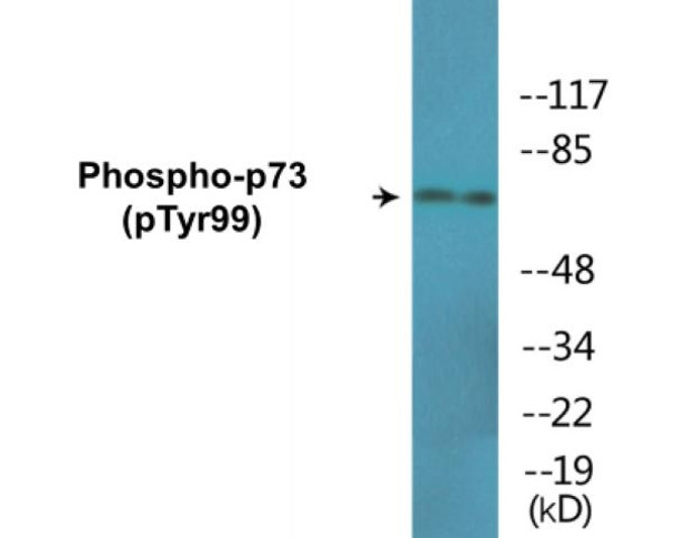 p73 (Phospho-Tyr99)Colorimetric Cell-Based ELISA Kit (CBCAB01593)