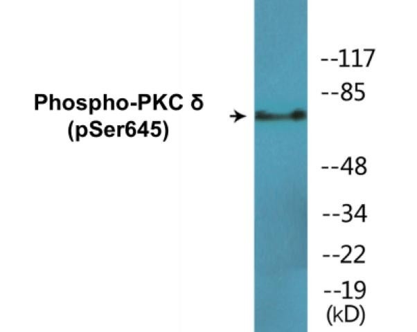 PKC delta (Phospho-Ser645)Colorimetric Cell-Based ELISA Kit (CBCAB01597)