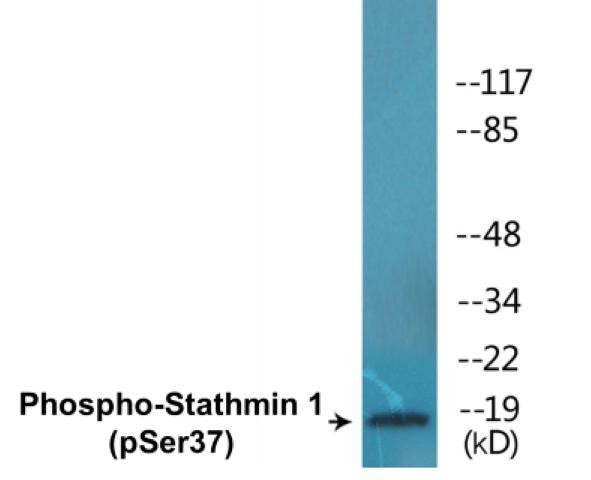 Stathmin 1 (Phospho-Ser37)Colorimetric Cell-Based ELISA Kit (CBCAB01613)