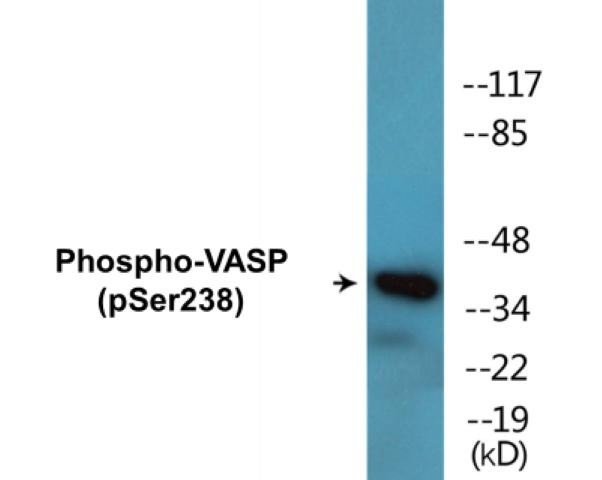 VASP (Phospho-Ser238)Colorimetric Cell-Based ELISA Kit (CBCAB01619)