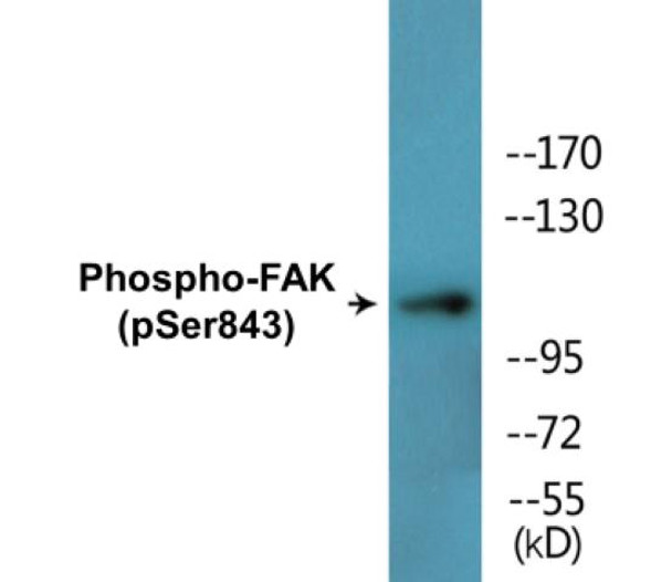 FAK (Phospho-Ser843)Colorimetric Cell-Based ELISA Kit (CBCAB01628)