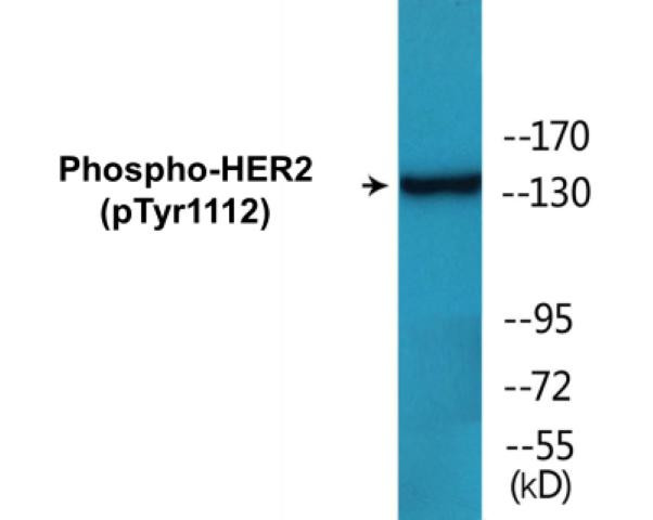 HER2 (Phospho-Tyr1112)Colorimetric Cell-Based ELISA Kit (CBCAB01630)