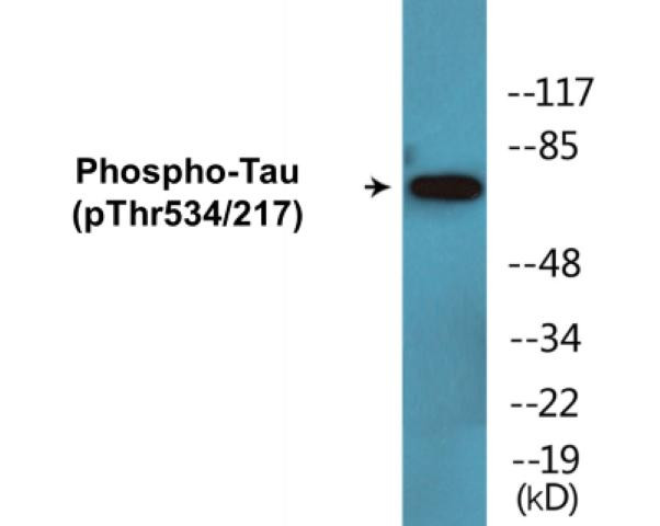 Tau (Phospho-Thr534/217)Colorimetric Cell-Based ELISA Kit (CBCAB01637)