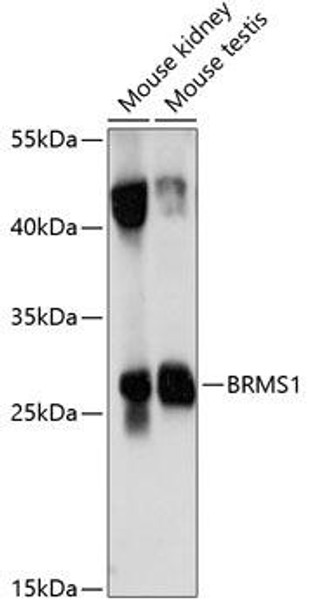 Anti-BRMS1 Antibody (CAB14865)