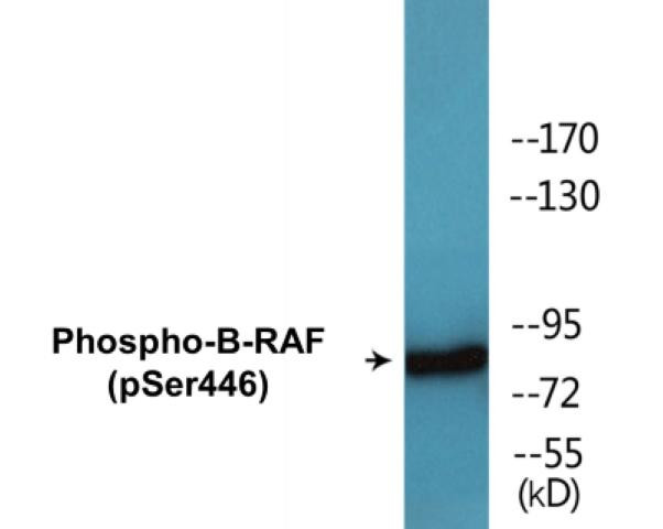 B-RAF (Phospho-Ser446)Colorimetric Cell-Based ELISA Kit (CBCAB01641)