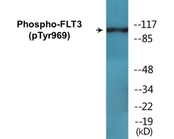 FLT3 (Phospho-Tyr969)Colorimetric Cell-Based ELISA Kit (CBCAB01644)