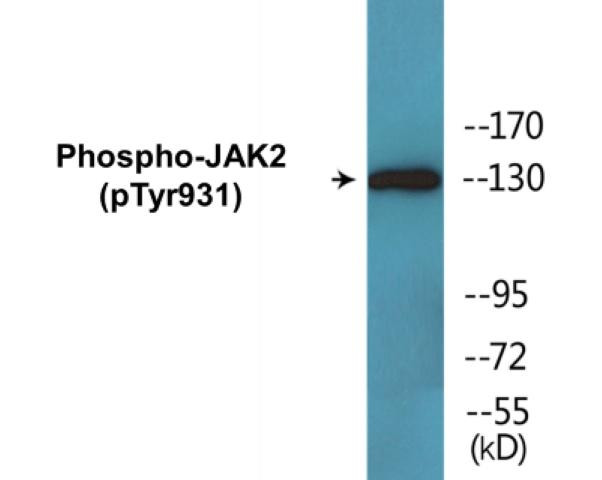 JAK2 (Phospho-Tyr931)Colorimetric Cell-Based ELISA Kit (CBCAB01646)