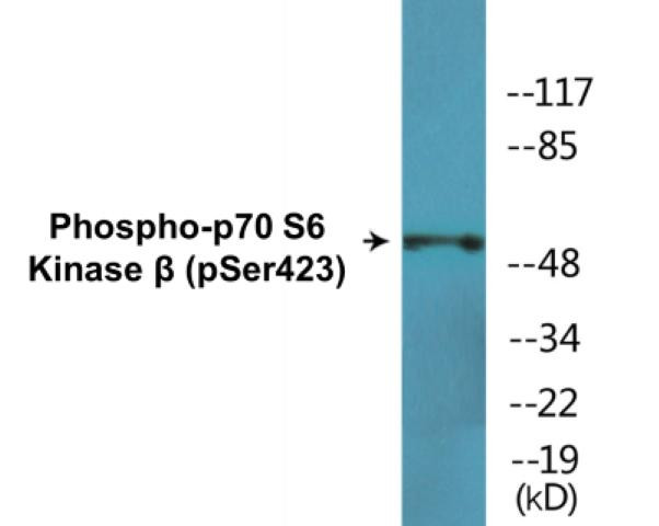 p70 S6 Kinase beta (Phospho-Ser423)Colorimetric Cell-Based ELISA Kit (CBCAB01651)