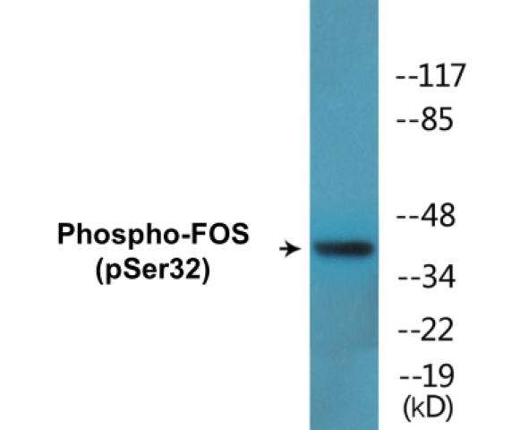FOS (Phospho-Ser32)Colorimetric Cell-Based ELISA Kit (CBCAB01658)