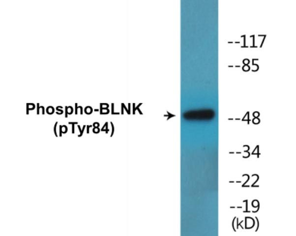 BLNK (Phospho-Tyr84)Colorimetric Cell-Based ELISA Kit (CBCAB01659)