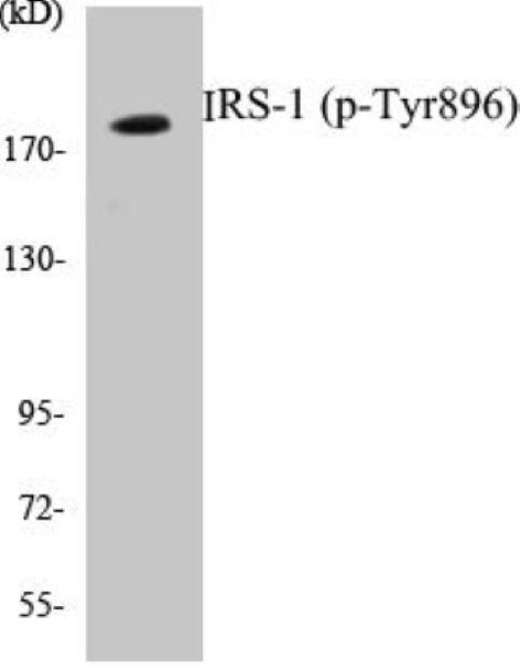 IRS-1 (Phospho-Tyr896)Colorimetric Cell-Based ELISA Kit (CBCAB01660)