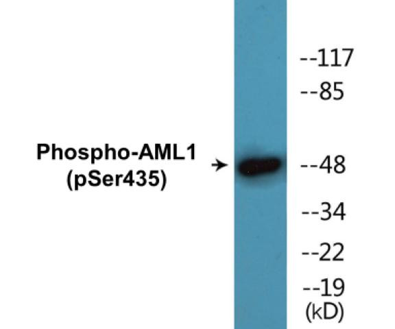 AML1 (Phospho-Ser435)Colorimetric Cell-Based ELISA Kit (CBCAB01670)