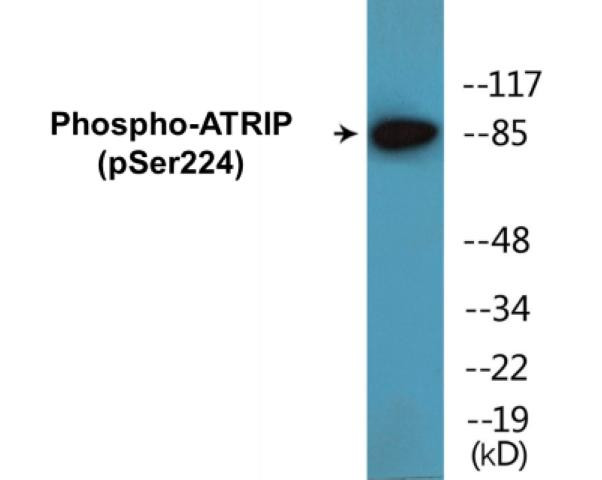 ATRIP (Phospho-Ser224)Colorimetric Cell-Based ELISA Kit (CBCAB01671)
