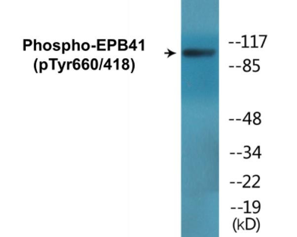 EPB41 (Phospho-Tyr660/418)Colorimetric Cell-Based ELISA Kit (CBCAB01679)