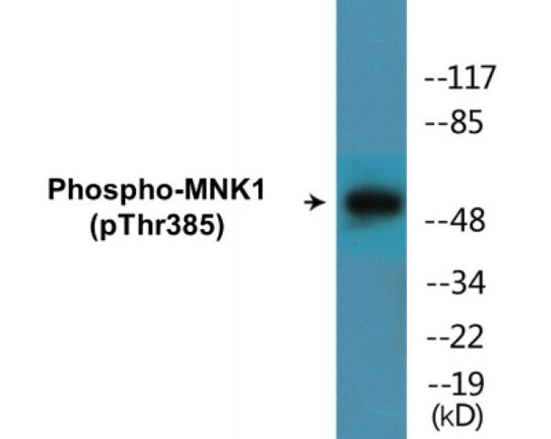 MNK1 (Phospho-Thr385)Colorimetric Cell-Based ELISA Kit (CBCAB01684)