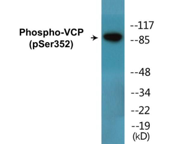 VCP (Phospho-Ser352)Colorimetric Cell-Based ELISA Kit (CBCAB01693)