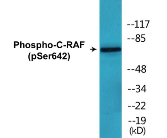 Phospho-C-RAF (Ser642)In-Cell ELISA (CBCAB01703)