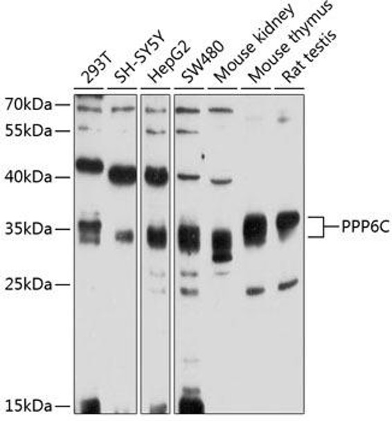 Anti-PPP6C Antibody (CAB4039)