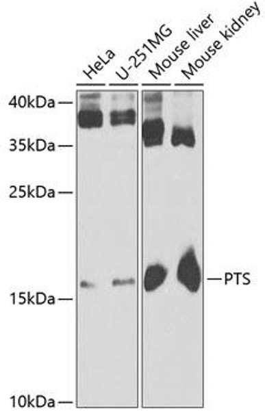 Anti-PTS Antibody (CAB6306)
