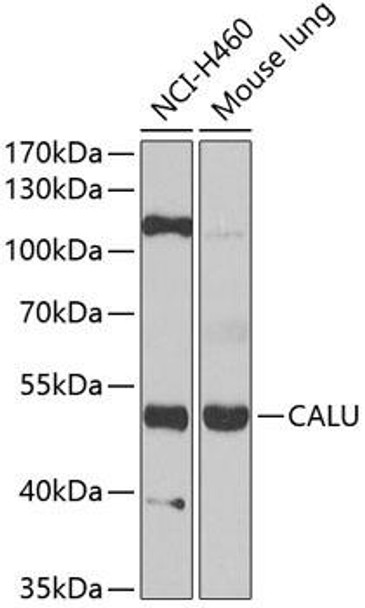 Anti-CALU Antibody (CAB6538)