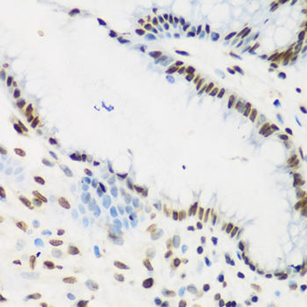 Anti-KLF4 Antibody (CAB6640)