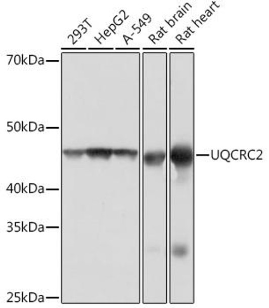 Anti-UQCRC2 Antibody (CAB4366)