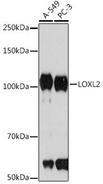 Anti-LOXL2 Antibody (CAB4708)
