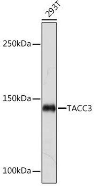 Anti-TACC3 Antibody (CAB19617)