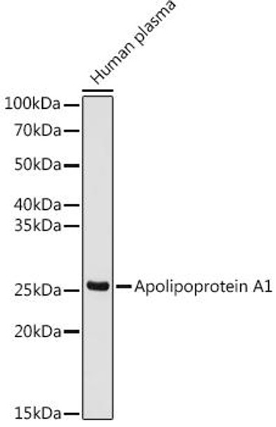 Anti-Apolipoprotein A1 Antibody (CAB4163)