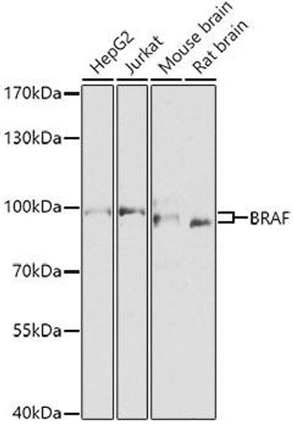 Anti-BRAF Antibody (CAB0038)
