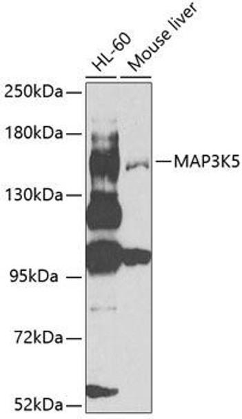 Anti-MAP3K5 Antibody (CAB0283)