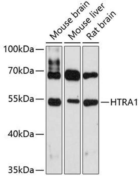 Anti-HTRA1 Antibody (CAB11693)